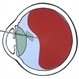 Penetrating Foreign Body Cartoon